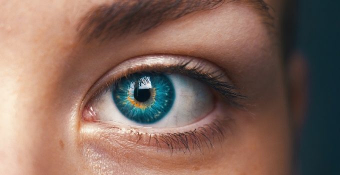 Strabismus
