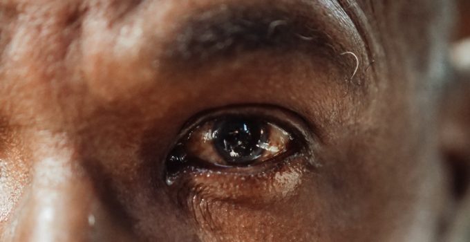 What You Should Know About Age-Related Eye Conditions